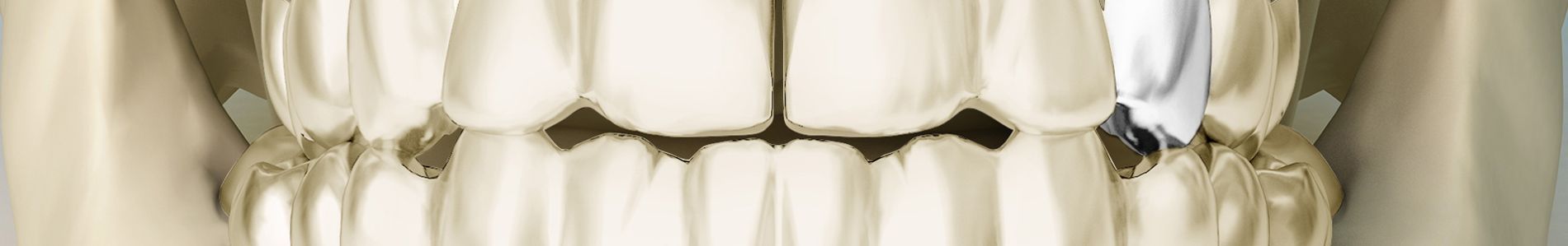 Ring Di Alarm header